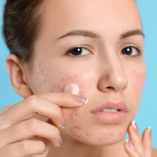 AcneOff - Onzichtbare acne-verwijderende puistjespleister