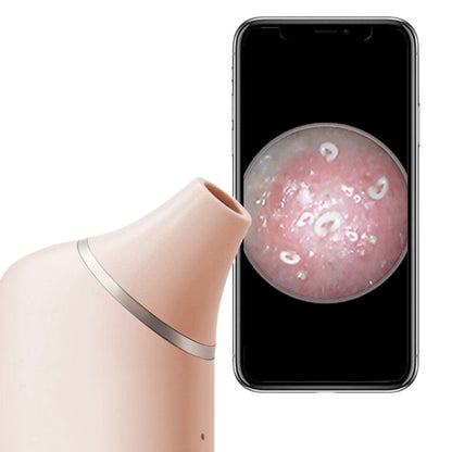 SkinClear - Camera AI Visuele Mee-eter Verwijderaar 